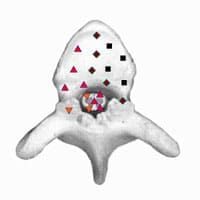 лечения онкологии поджелудочной железы