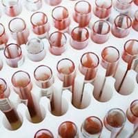 рак простаты