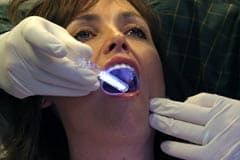 рак ротовой полости