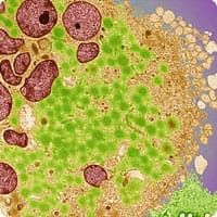 рак профилактика